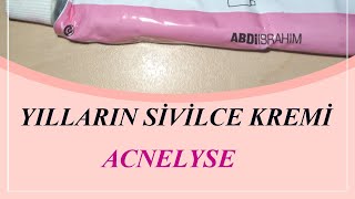 ACNELYSE KREM YILLARIN SİVİLCE KREMİ [upl. by Tidwell422]