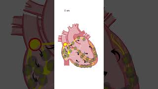 Potential Ectopic Pacemakers hearthealth medicine medicalstudent medicalschool doctor nurse [upl. by Jarred]