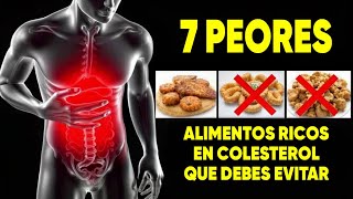 ⚠️ ¡CUIDADO Estos son los 7 ALIMENTOS con MÁS COLESTEROL que debes evitar y [upl. by Riella]