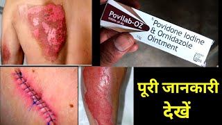 Povilab OZ Ointment Uses Or Side Effects in hindi [upl. by Woodrow]