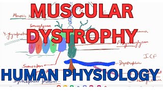 Muscular dystrophy Duchenne muscular dystrophy Beckers and Limb GIrdle muscular dystrophy [upl. by Jari]