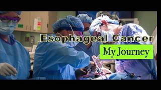 Esophageal Cancer My Journey 9 [upl. by Noli]