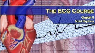 The ECG Course  Atrial Rhythms [upl. by Kendy]