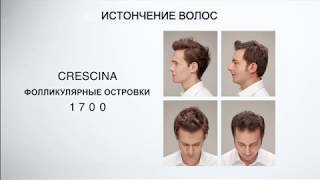 Crescina HFI Hair Follicular Islands  интенсивный курс для возобновления роста волос [upl. by Clauddetta]