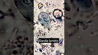 Giardia lambliaGiardiasis parasiteparasite under microscope microscopy parasitology [upl. by Rozelle629]