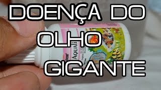 DOENÇA DO OLHO GIGANTE [upl. by Athena]