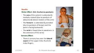 Lesion of Brachial plexus [upl. by Baillie614]