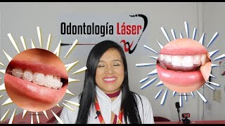 Si estás buscando ortodoncia  Odontología Láser [upl. by Roshan315]