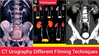 CT Urography Trace Ureters Filmy technique In Hindi  Cturography Radiologydept Ctscan ctkub [upl. by Armington]