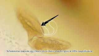 Schistosoma mansoni Egg under the microscope [upl. by Picardi]