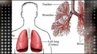 Cure dry cough Emphysema bronchitis natural cure Treating and remedies [upl. by Cailly]