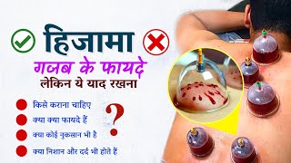 Hijama क्या होता है  कब कैसे और किन लोगों को कराना चाहिए  Hijama Cupping therapy ke fayde [upl. by Ojytteb558]