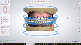 Ivotion Monolithic Denture Design [upl. by O'Hara960]