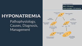 Hyponatremia  Pathophysiology Causes Diagnostic Approach amp Management 😊 AllinOne Package 😊 [upl. by Vanhomrigh]