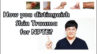 Skin trauma Contusion Ecchymosis Petechiae Laceration Abrasion NPTE topics [upl. by Nwahsyar]