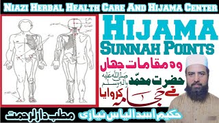 HIJAMA SUNNAH POINTS     Part 2 [upl. by Demetra]