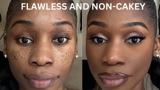 PITTED ACNE SCAR MAKEUP TUTORIAL STEP BY STEP ICEPICK SCARSBOXCAR SCARSCRATERS [upl. by Mcbride]