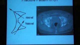 12 Radiological diagnosis of the acetabulum H Abdel Azeem [upl. by Marnia]