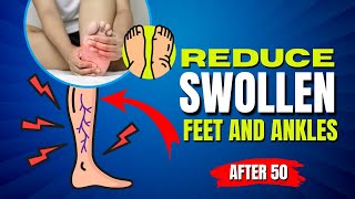 What to Do If You Got Swollen Feet and Ankles Here are 6 Easy Solutions [upl. by Narret897]