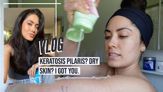 This is how I manage my Keratosis Pilaris KP and dry skin on my body  Melissa Alatorre [upl. by Yrred885]