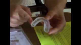 ProDental 3in1 Mouth Guard Review [upl. by Greene]