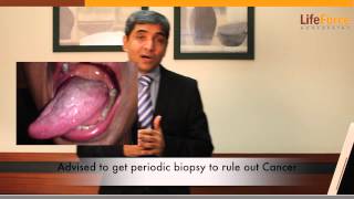 Treatment for Oral Lichen Planus Explained by Dr Rajesh Shah MD [upl. by Anib519]