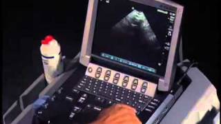 How To Transabdominal View of the Female Pelvis with Ultrasound [upl. by Nivrag]