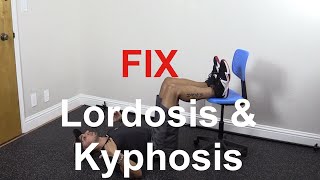 How to fix lordosis and kyphosis together [upl. by Ellemrac]