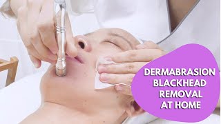 How To Use Diamond Dermabrasion Blackhead Removal Machine At Home  21P2 myChway [upl. by Hahsia691]