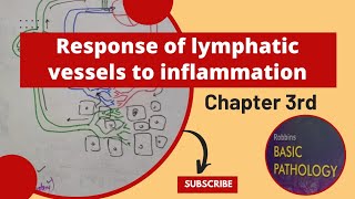 Responses of Lymphatic Vessels and Lymph Nodes to Inflammation LymphangitisLymphadenitisrobbins [upl. by Jany949]