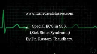 ECG Sick Sinus SyndromeSSS by Dr Rustam Chaudhary [upl. by Naitsirt]