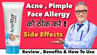 Acne Star Face Wash Review  Benefits amp How To Use [upl. by Adaynek]