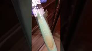 Mycobacterium tuberculosis TB on LJ agar  Microbiology [upl. by Arramas]