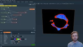 How to Perform Trabecular and Cortical Bone Segmentation [upl. by Noll]