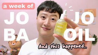 I Tried JOJOBA OIL On My Skin Everyday For a Week And This Happened  Korean Skincare [upl. by Handal]