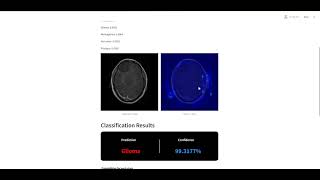 Brain tumor Machine learning Classification project with Streamlit UI [upl. by Clio]