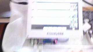 ECG Test SCE monitor [upl. by Rehttam]