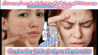 Pimples Acne finish of only one Disprin tabletNeat and clean skinKOMAL beauty voice [upl. by Selrahcnhoj315]