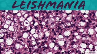 Leishmaniasis 5Minute Pathology Pearls [upl. by Arised]