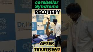 Stroke Recovery After treatment ad viral video fyp [upl. by Einnil]