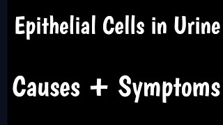 Epithelial Cells in Urine Test  Causes amp Symptoms Of Epithelial Cells in Urine  Urine Analysis [upl. by Ebert]