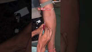 Iv injection viralvideo li [upl. by Riana775]