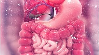 Intestinal obstruction part 2 and Benign tumor of intestine [upl. by Lema]