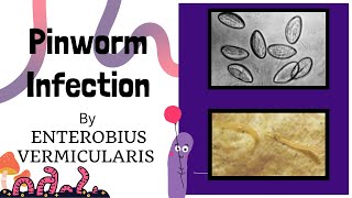 Pinworm Infection Causes and Treatment  Life Cycle of Pinworm Intestinal nematodes Novice Medic [upl. by Zinck]