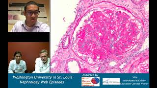 Nephrology Web Episode 021  Renal Pathology Teaching Series MPGN with Drs Rodby and Charag [upl. by Dnartreb]