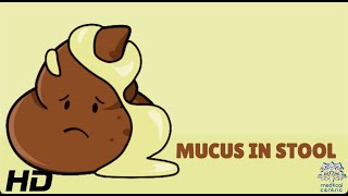 Mucus In Stool Everything You Need To Know [upl. by Lleksah]