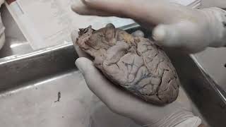 Dissection of Brain 🧠 sulci and gyri Anatomy mbbs 1stprof viva [upl. by Nirual]