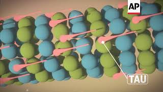 CTE How Repeated Head Blows Affect the Brain [upl. by Einnim]