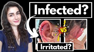 Doctor explains Is your piercing infected How to care for a new cartilage piercing [upl. by Horbal66]