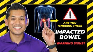 Are You Ignoring These Impacted Bowel Warning Signs 🚨 [upl. by Krahmer]